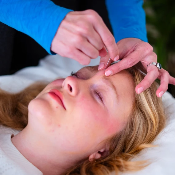 Acupuncture Services Toronto