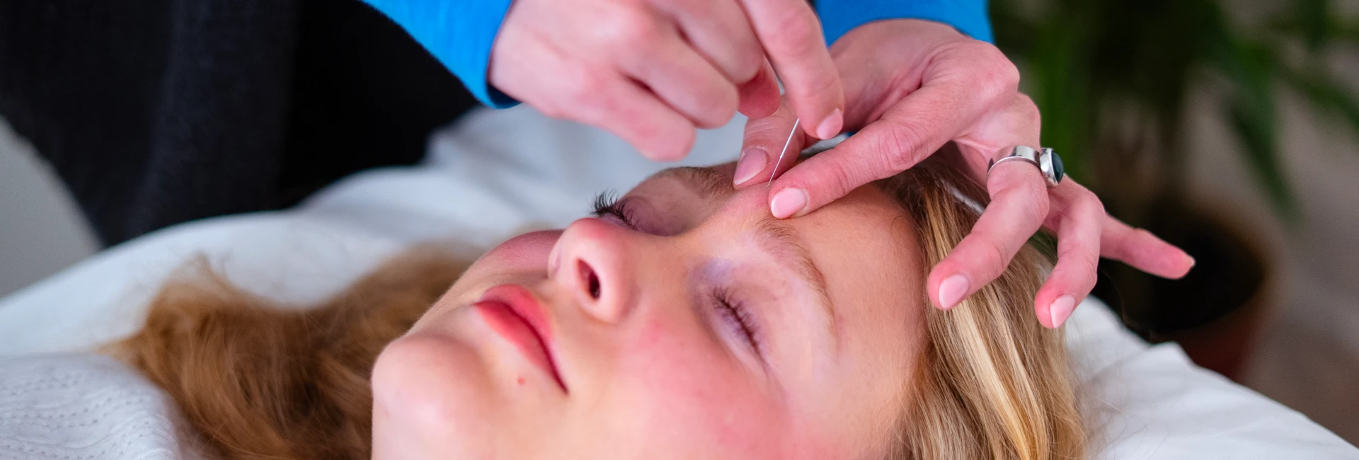 Acupuncture Services Toronto