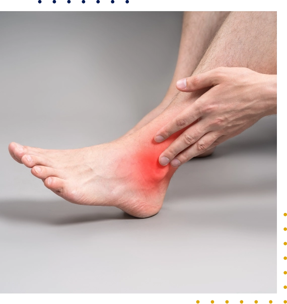 Manage Inflammation And Daily Symptoms