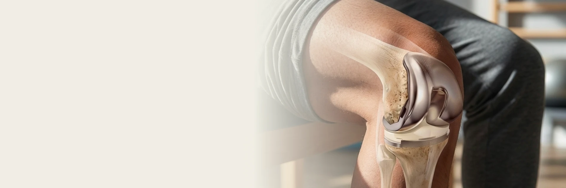 Joint Replacement Rehabilitation