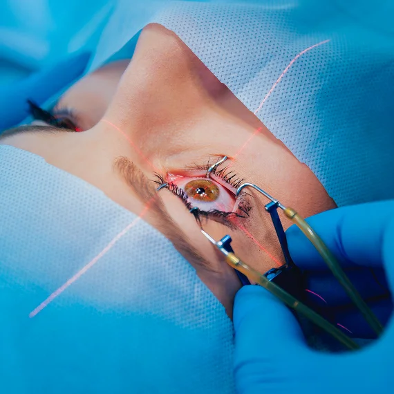 Refractive Surgery Co Management