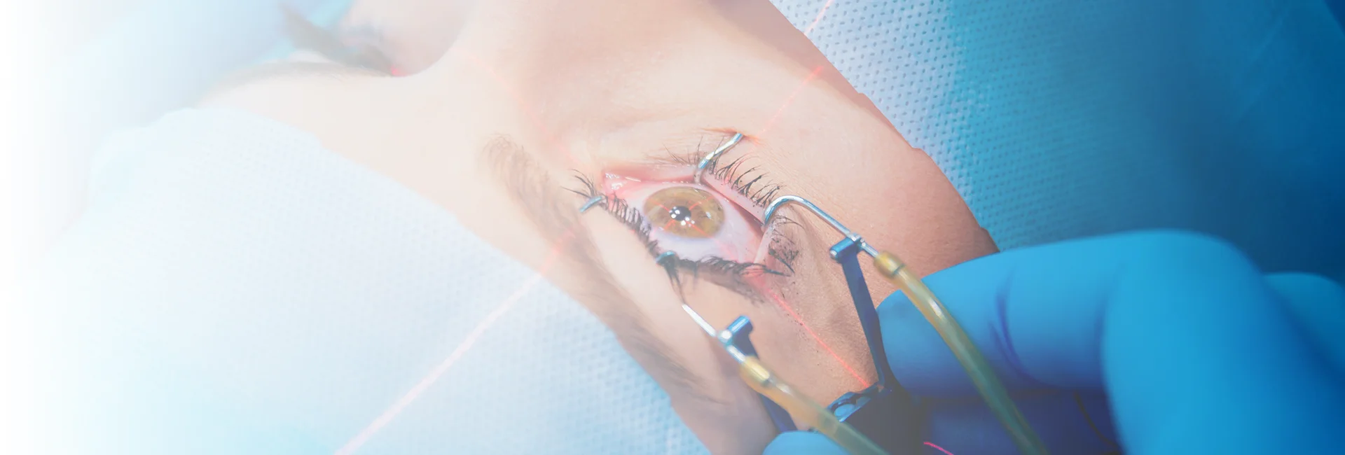 Refractive Surgery Co Management