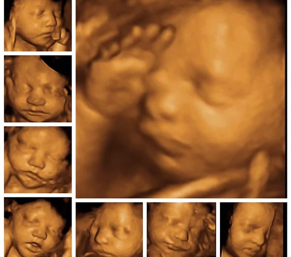 Mobile ultrasound brought directly to the communities served