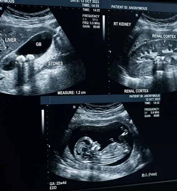 Prenatal imaging session monitoring baby's development