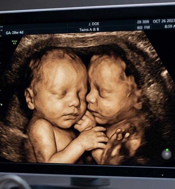 Real-time 4D imaging of fetal movement on screen